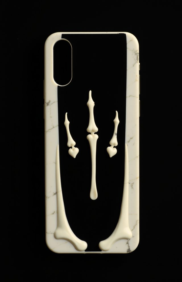 Floating Metacarpals