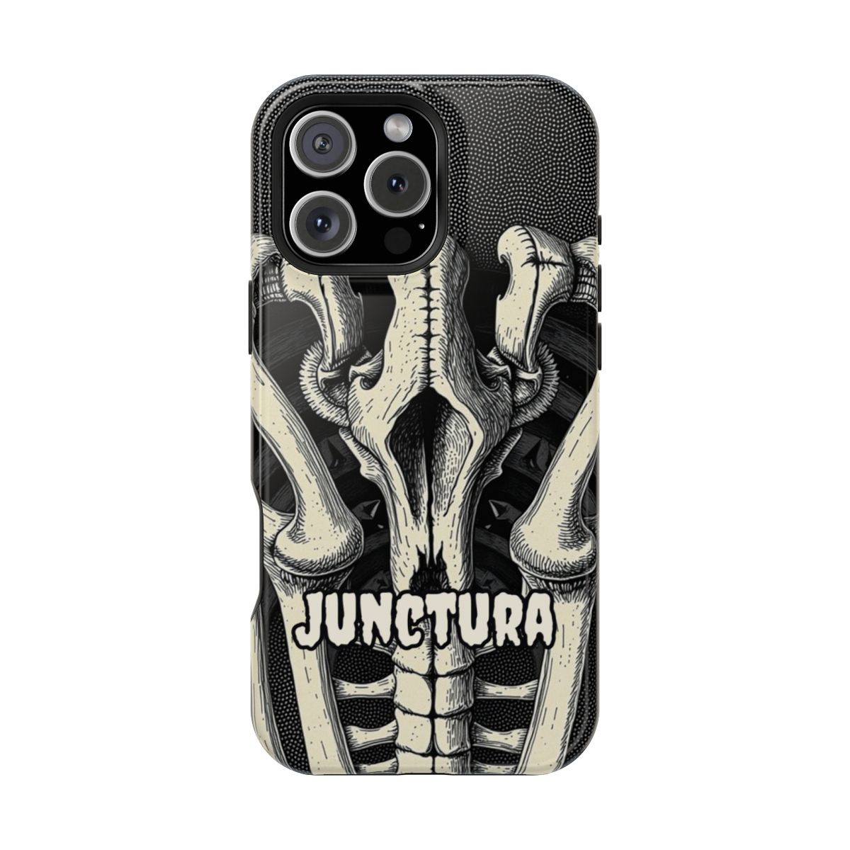 Sutural Bones